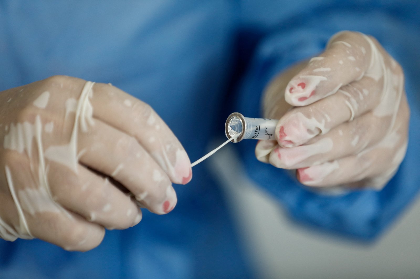A health worker prepares a sample of test for COVID-19, Porto Alegre, Brazil, Jan. 20, 2022. (Reuters Photo)