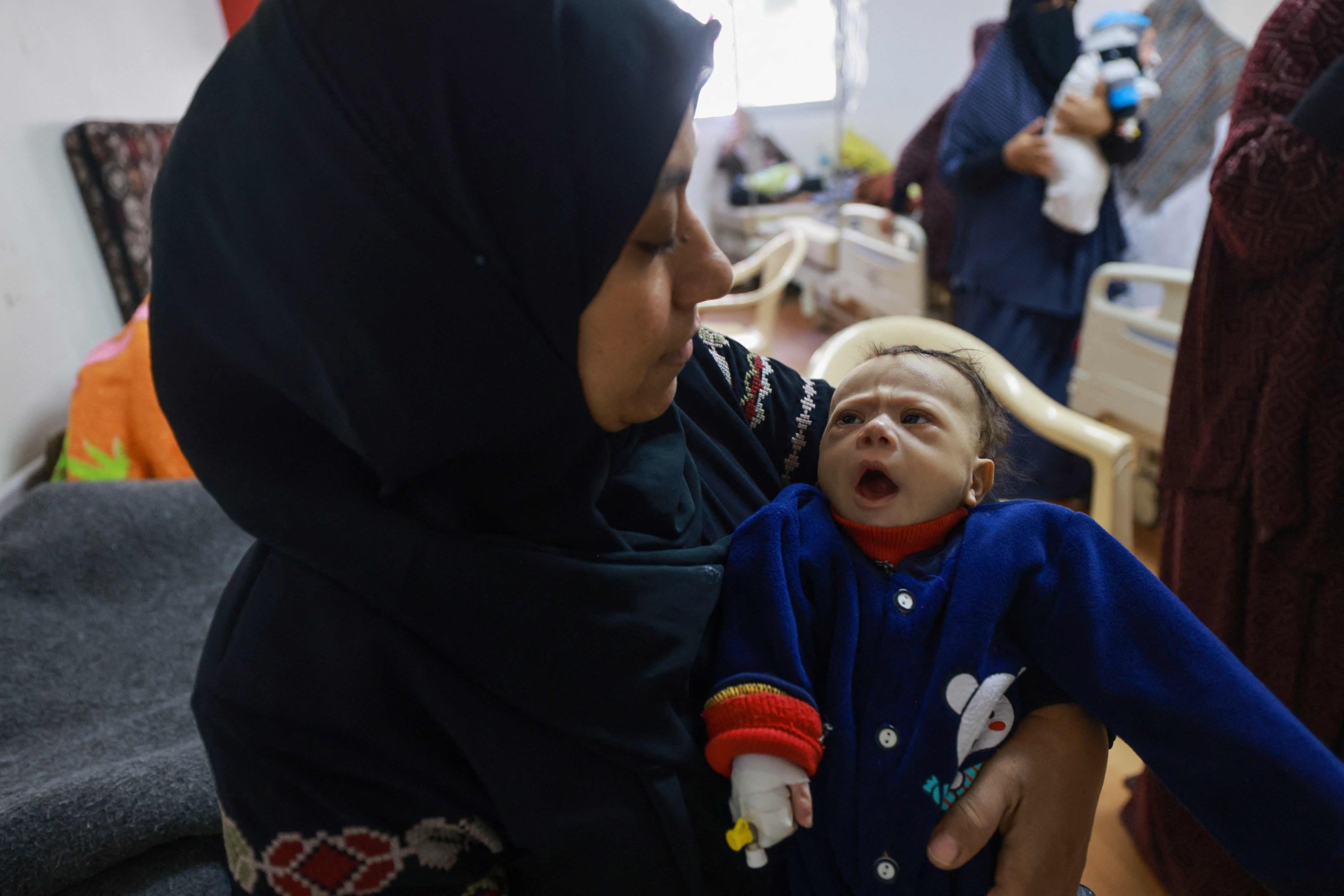 318195 Palestinian children suffering from malnutrition receive treatment at a healthcare center in Rafah, southern Gaza Strip, Palestine, March 5, 2024. (AFP Photo)