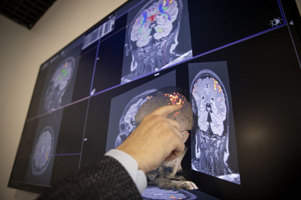 Study unveils link between dopamine, stress and time perception in the brain, Ankara University, Ankara, Türkiye, March 14, 2024. (AA Photo)