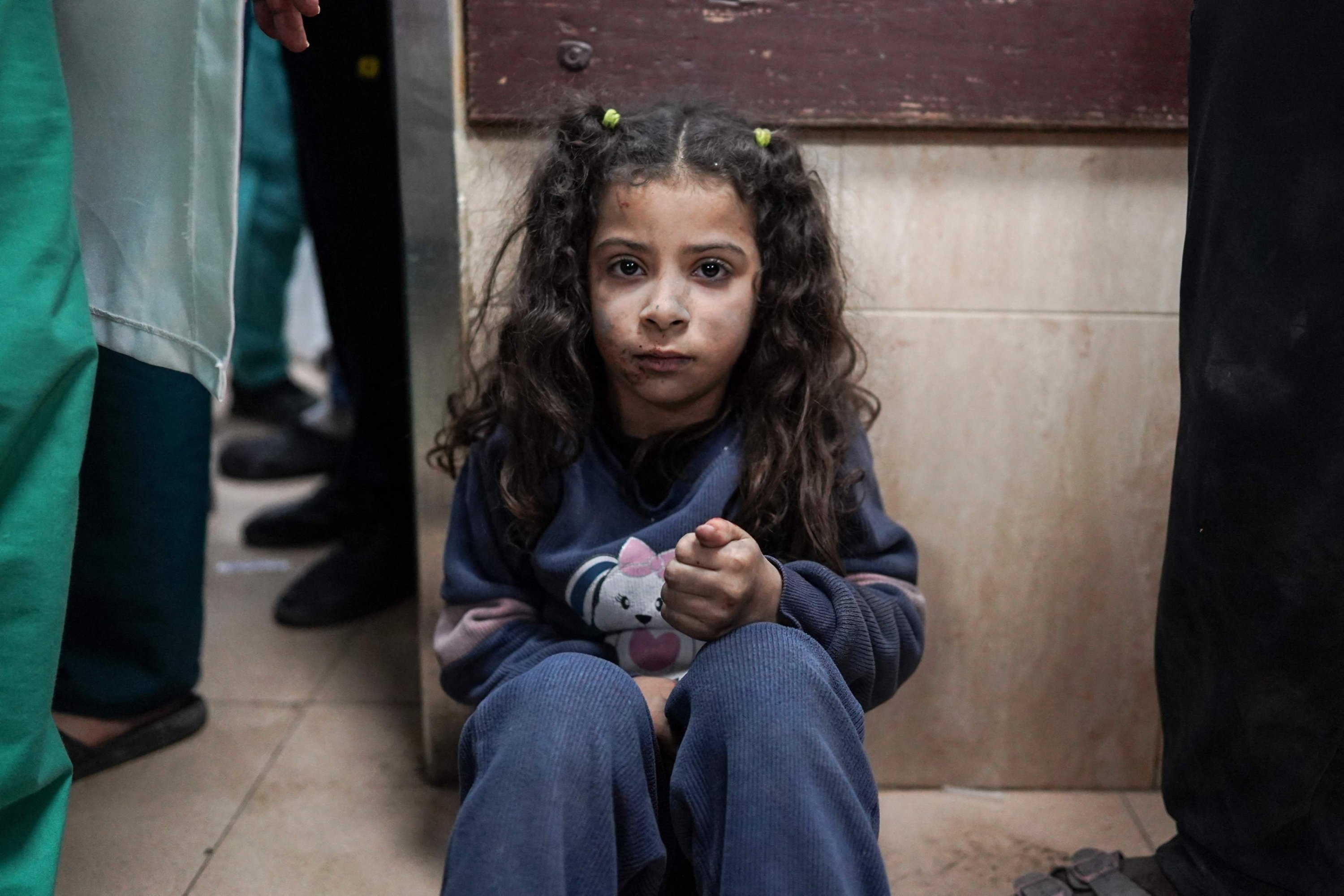 320378 A Palestinian girl sits on the floor of the emergency area in the Al-Aqsa Martyrs Hospital in Deir al-Balah, Gaza, Palestine, March 19, 2024. (AFP Photo)
