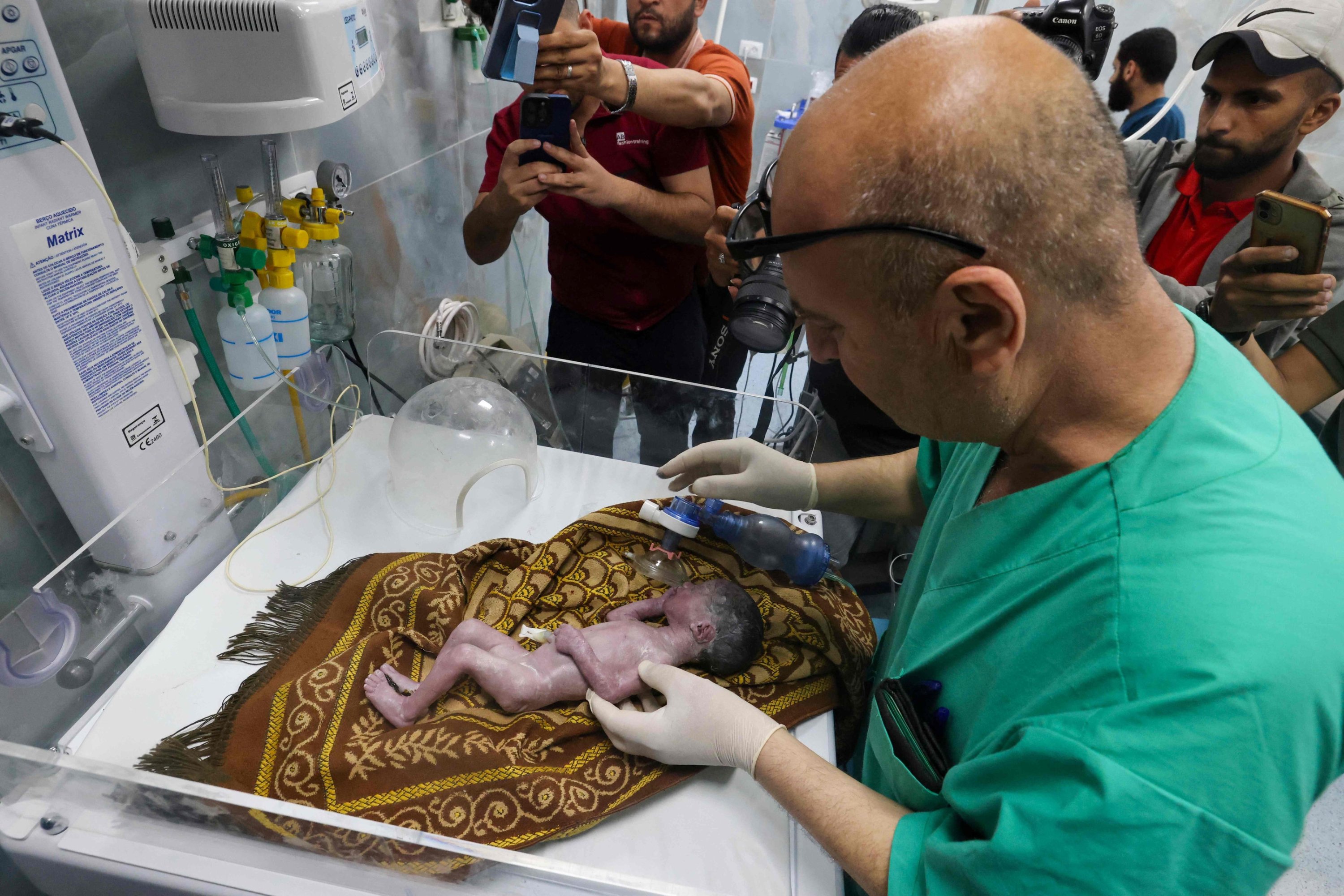 324438 A Palestinian doctor tends to a baby born prematurely after his mother was injured during Israeli bombardment, at the Kuwait Hospital, Rafah, Gaza Strip, Palestine, April 20, 2024. (AFP Photo)
