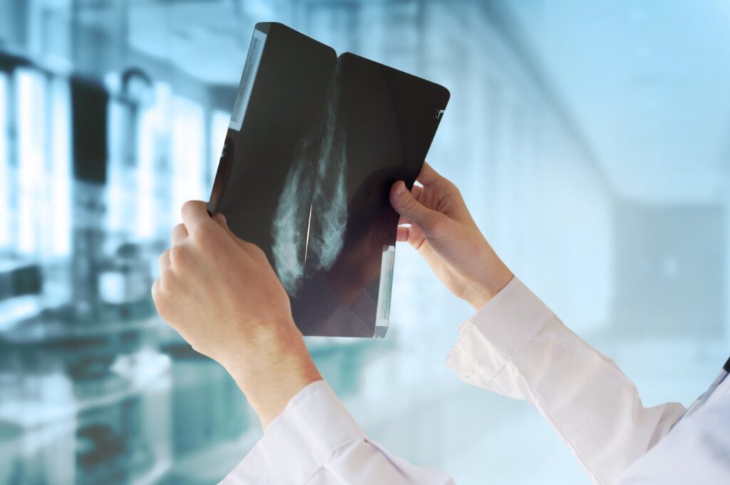 A high-fat diet is a "high-risk factor for the malignant progression of cancers through the disruption of the intestinal microbiota," according to the researchers. (Shutterstock Photo)