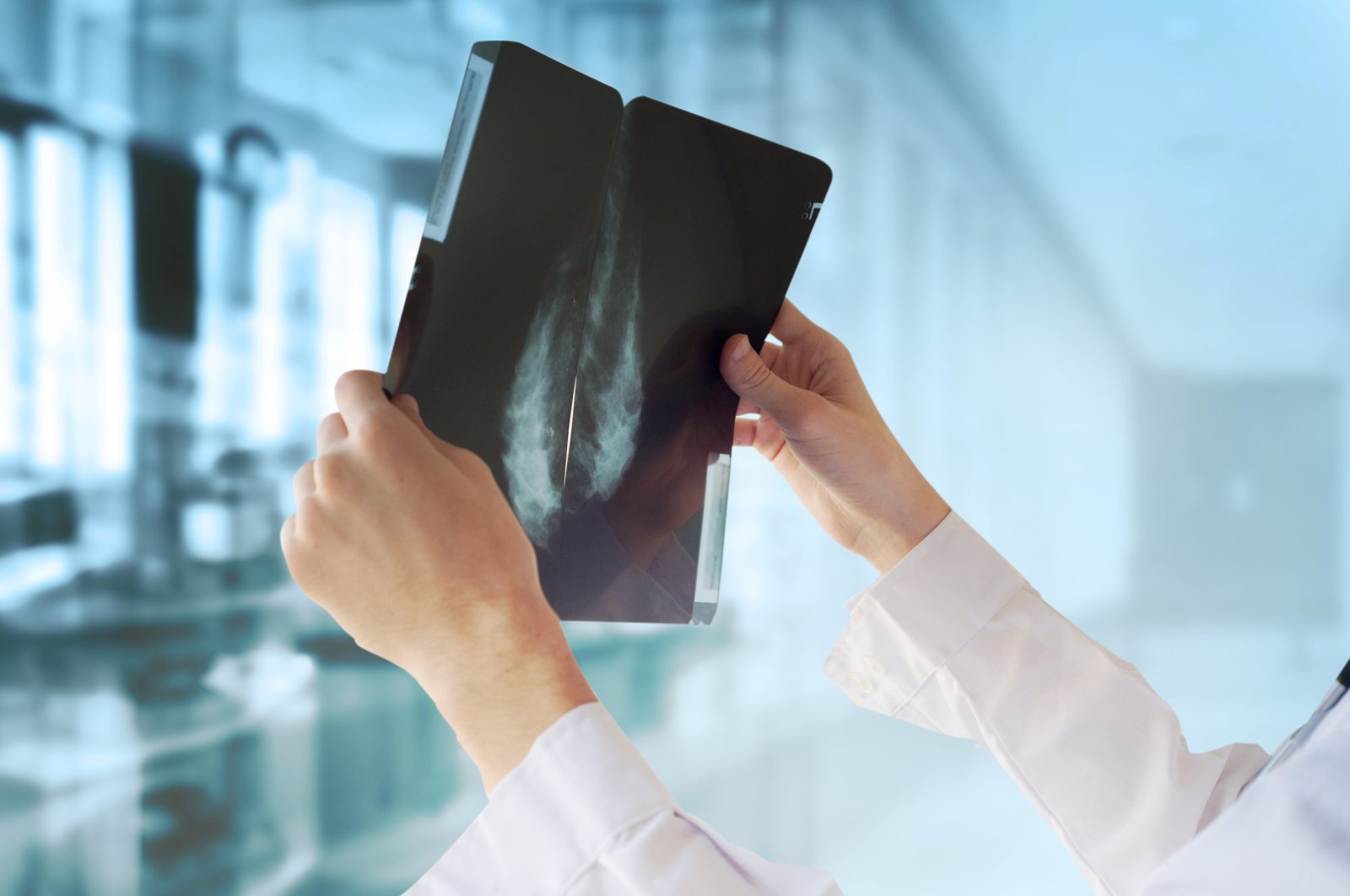 A high-fat diet is a "high-risk factor for the malignant progression of cancers through the disruption of the intestinal microbiota," according to the researchers. (Shutterstock Photo)