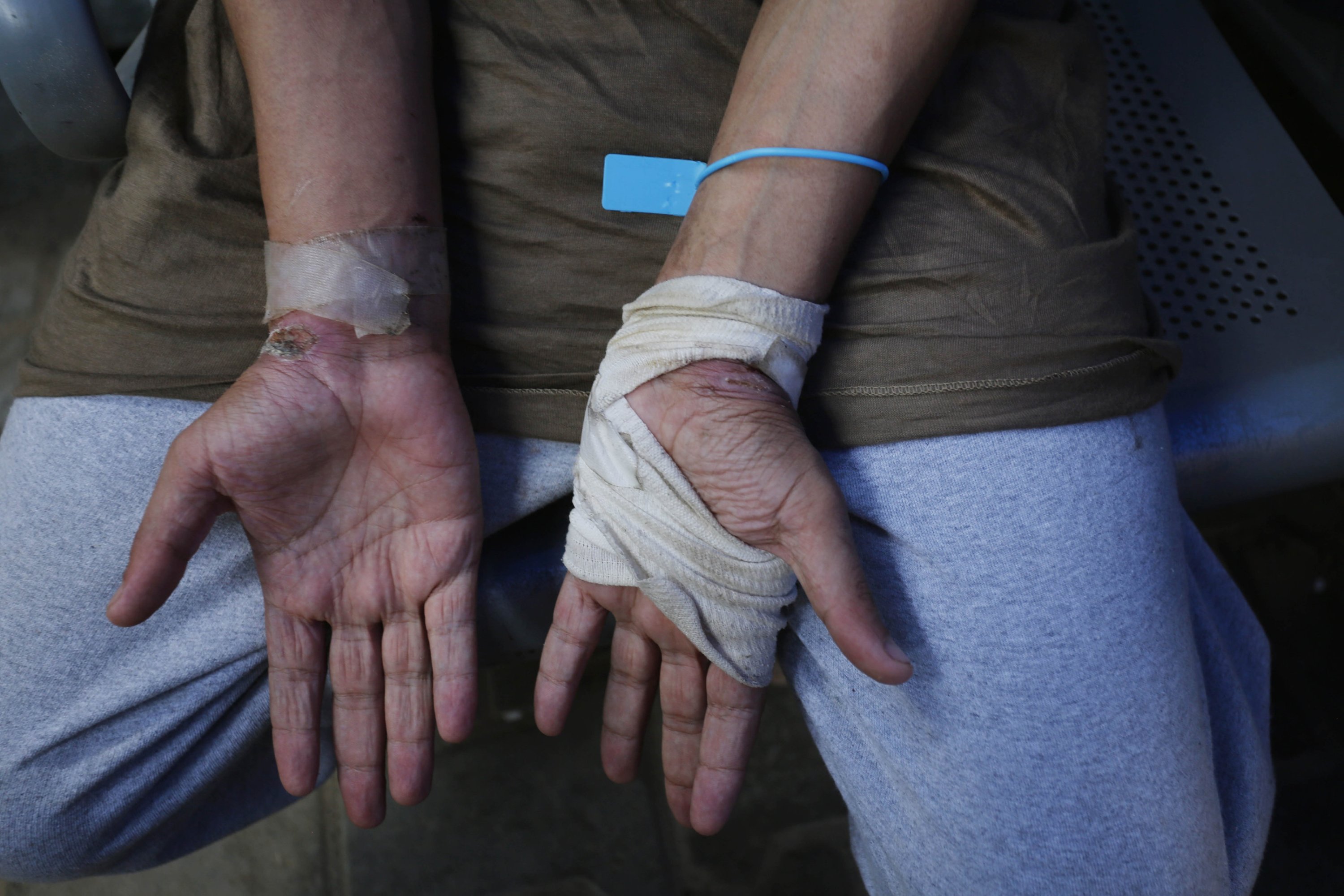 333280 Palestinian show signs of torture after being released from Israeli prisons, Deir al-Balah, Gaza, Palestine, June 20, 2024. (AA Photo)