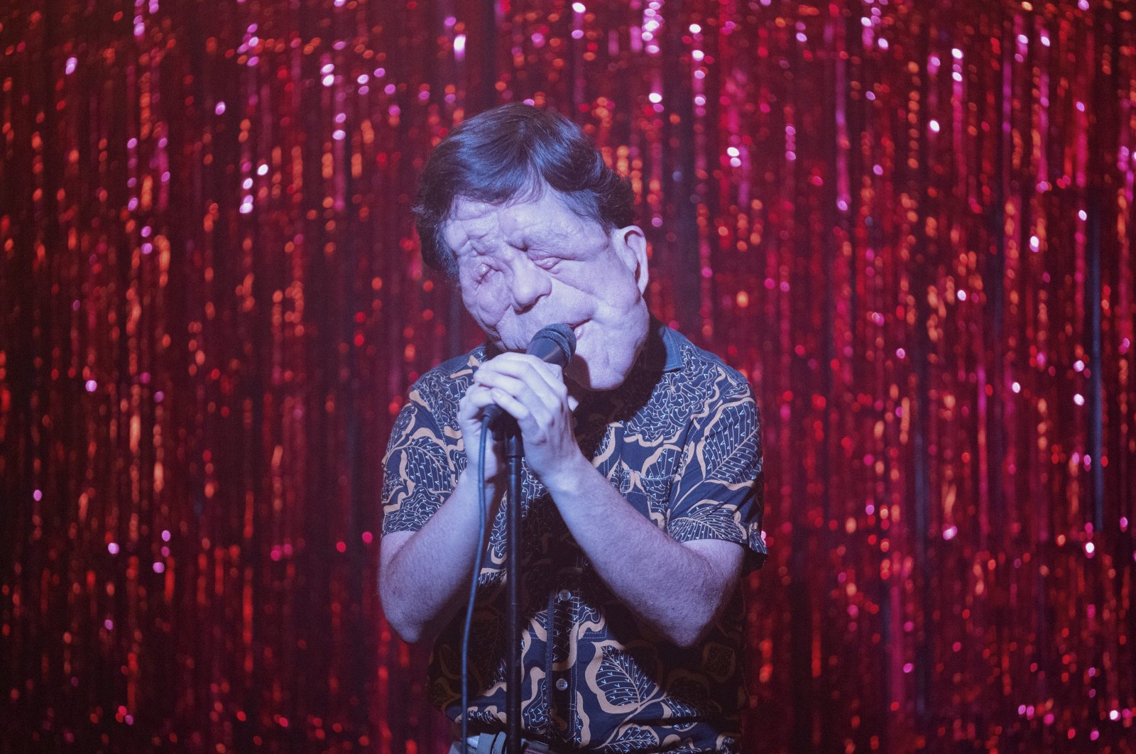 This image released by A24 shows Adam Pearson in a scene from "A Different Man." (AP Photo)