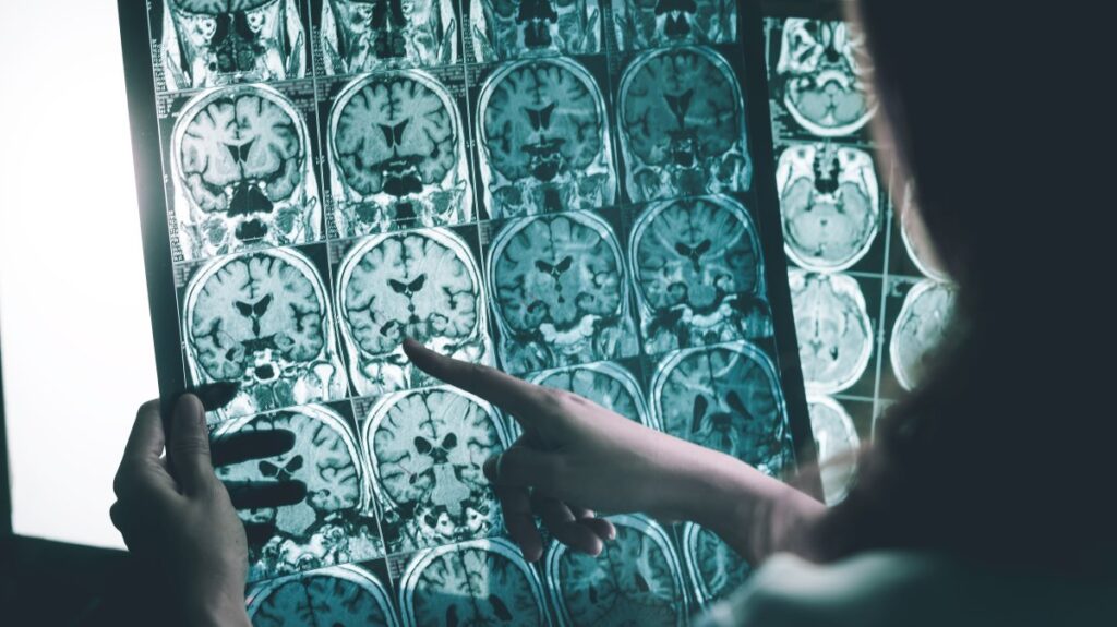 Chinese scientists have revealed the intrinsic link between the topological structure of human brain cortex connections and genetic characteristics. (AP Photo)