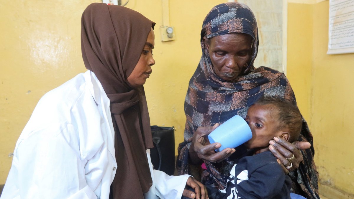 A mother feeds her child, who is suffering from malnutrition, next to a doctor in Khartoum, Sudan, March 15, 2025. (Reuters Photo)