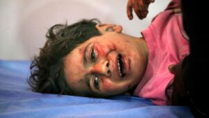 An injured child cries while receiving medical care at the al-Awda Hospital in the Nuseirat refugee camp, central Gaza Strip, Palestine, May 29, 2025. (AFP Photo)